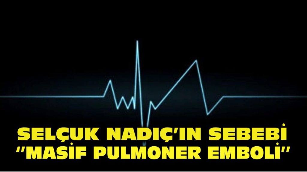 Selçuk Nadıç’ın ölüm sebebi “masif pulmoner emboli”