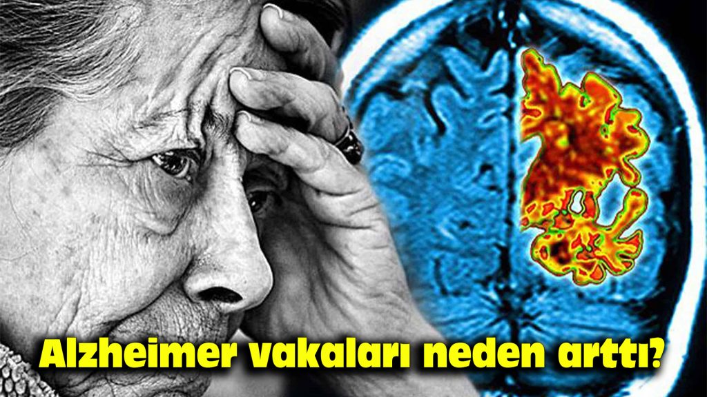 Alzheimer vakaları neden arttı?